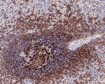 CD21 Antibody in Immunohistochemistry (Paraffin) (IHC (P))