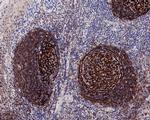 CD21 Antibody in Immunohistochemistry (Paraffin) (IHC (P))