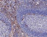 CD13 Antibody in Immunohistochemistry (Paraffin) (IHC (P))