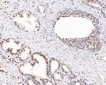 Androgen Receptor Antibody in Immunohistochemistry (Paraffin) (IHC (P))