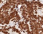 c-Kit Antibody in Immunohistochemistry (Paraffin) (IHC (P))