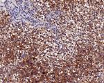 Placental Alkaline Phosphatase Antibody in Immunohistochemistry (Paraffin) (IHC (P))