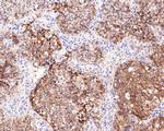 CD99 Antibody in Immunohistochemistry (Paraffin) (IHC (P))