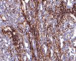 CD99 Antibody in Immunohistochemistry (Paraffin) (IHC (P))