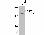 RICTOR Antibody in Western Blot (WB)