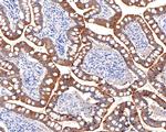 Villin Antibody in Immunohistochemistry (Paraffin) (IHC (P))