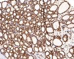 RBM3 Antibody in Immunohistochemistry (Paraffin) (IHC (P))