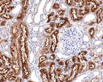 Villin Antibody in Immunohistochemistry (Paraffin) (IHC (P))