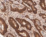 PIN4 Antibody in Immunohistochemistry (Paraffin) (IHC (P))