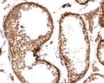 PIN4 Antibody in Immunohistochemistry (Paraffin) (IHC (P))