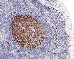 MCM6 Antibody in Immunohistochemistry (Paraffin) (IHC (P))