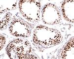 MCM6 Antibody in Immunohistochemistry (Paraffin) (IHC (P))