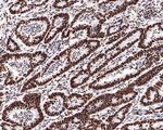 SF3A3 Antibody in Immunohistochemistry (Paraffin) (IHC (P))