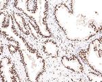 SF3A3 Antibody in Immunohistochemistry (Paraffin) (IHC (P))