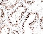 SF3A3 Antibody in Immunohistochemistry (Paraffin) (IHC (P))