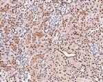 SF3A3 Antibody in Immunohistochemistry (Paraffin) (IHC (P))