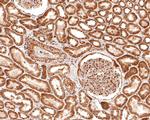 NOLC1 Antibody in Immunohistochemistry (Paraffin) (IHC (P))