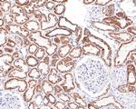 NDUFB4 Antibody in Immunohistochemistry (Paraffin) (IHC (P))