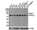 PGM1 Antibody in Western Blot (WB)
