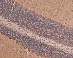 RPS8 Antibody in Immunohistochemistry (Paraffin) (IHC (P))