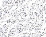 hnRNP M Antibody in Immunohistochemistry (Paraffin) (IHC (P))