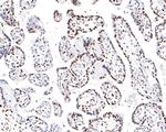 hnRNP M Antibody in Immunohistochemistry (Paraffin) (IHC (P))