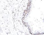 hnRNP M Antibody in Immunohistochemistry (Paraffin) (IHC (P))