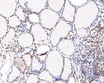 hnRNP M Antibody in Immunohistochemistry (Paraffin) (IHC (P))