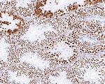 hnRNP M Antibody in Immunohistochemistry (Paraffin) (IHC (P))