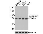 hnRNP M Antibody in Western Blot (WB)