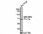 hnRNP M Antibody in Western Blot (WB)