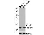 ACAT1 Antibody in Western Blot (WB)