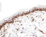 PRPF31 Antibody in Immunohistochemistry (Paraffin) (IHC (P))