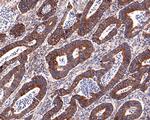 NSDHL Antibody in Immunohistochemistry (Paraffin) (IHC (P))