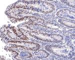 PNK Antibody in Immunohistochemistry (Paraffin) (IHC (P))