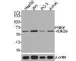 PNK Antibody in Western Blot (WB)