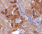 SNX5 Antibody in Immunohistochemistry (Paraffin) (IHC (P))