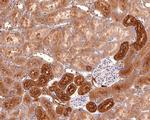 SNX5 Antibody in Immunohistochemistry (Paraffin) (IHC (P))