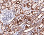 NDUFS2 Antibody in Immunohistochemistry (Paraffin) (IHC (P))