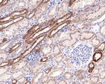 HAUS7 Antibody in Immunohistochemistry (Paraffin) (IHC (P))