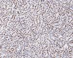 NUP50 Antibody in Immunohistochemistry (Paraffin) (IHC (P))