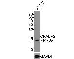 CRABP2 Antibody in Western Blot (WB)
