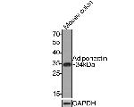 Adiponectin Antibody in Western Blot (WB)