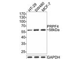 PRPF4 Antibody in Western Blot (WB)