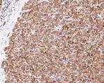 CRCP Antibody in Immunohistochemistry (Paraffin) (IHC (P))