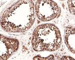 VDP Antibody in Immunohistochemistry (Paraffin) (IHC (P))