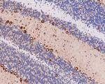 VDP Antibody in Immunohistochemistry (Paraffin) (IHC (P))