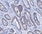 ACADS Antibody in Immunohistochemistry (Paraffin) (IHC (P))