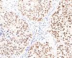 TRIM24 Antibody in Immunohistochemistry (Paraffin) (IHC (P))