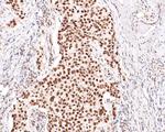 TRIM24 Antibody in Immunohistochemistry (Paraffin) (IHC (P))